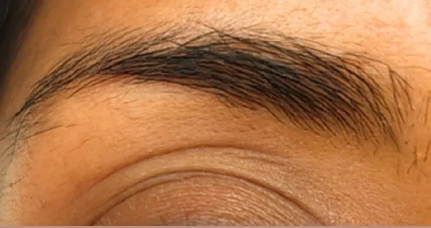 Brow lamination med tydelig struktur i hårene